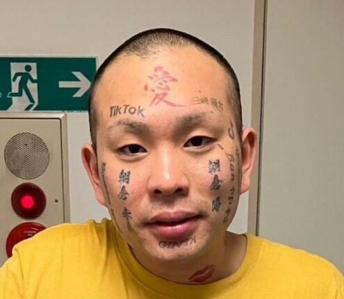 顔面ニキの画像①