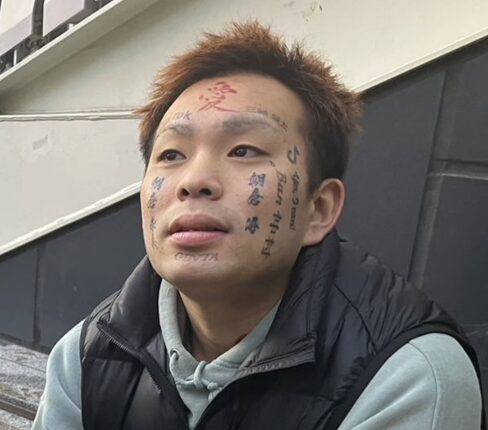 顔面ニキの画像③